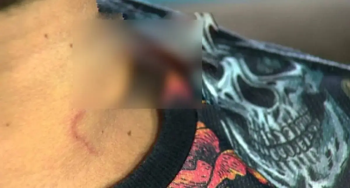 Mulher esfaqueia companheiro no pescoço para defender filha durante briga familiar em RO